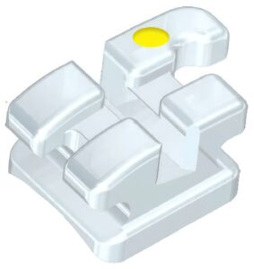 Pearl™ Ceramic Bracket System--gigapixel---